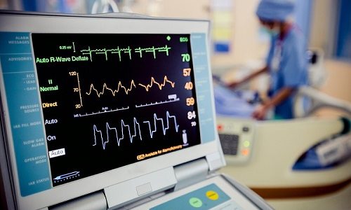 ecg